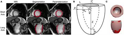 Gaussian Process Regressions for Inverse Problems and Parameter Searches in Models of Ventricular Mechanics